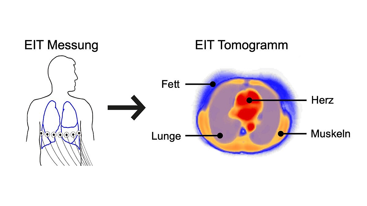 Die Collage zeigt einen menschlichen Umriss mit Lungenflügeln und Elektroden. Ein Pfeil zeigt auf ein Tomogramm mit einem farblich markierten Querschnitt von Lunge, Herz, Muskeln und Fettgewebe.