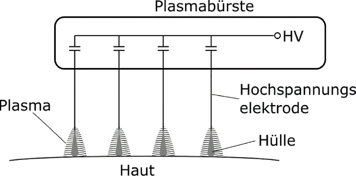 Die Skizze zeigt den Bürstengriff und vier Hochspannungselektroden als Zinken mit symbolhaftem Plasma.