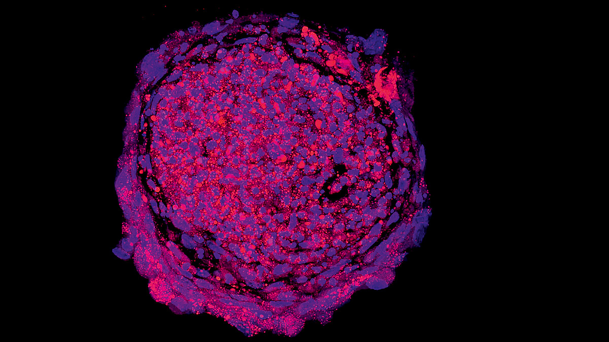 Fluoreszenzmikroskopische Aufnahme eines kugelförmigen Zellhaufens mit leuchtenden Markierungen