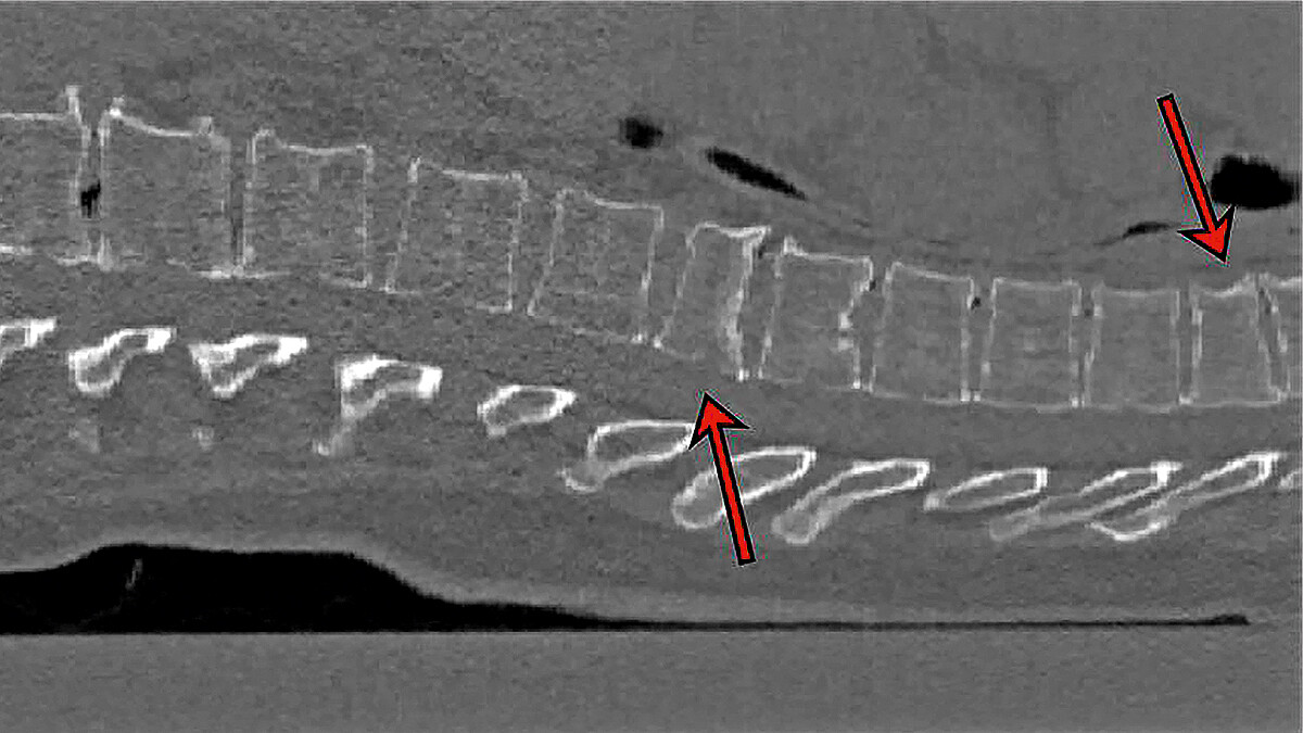 Das 2D-Schnittbild einer CT-Aufnahme zeigt eine Wirbelsäule. Zwei Pfeile weisen auf Wirbelfrakturen hin.